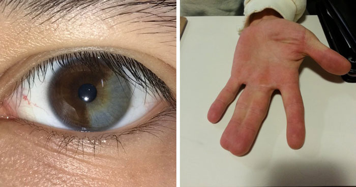 66 Stupefying Photos Of The Human Body That You May Not Have Seen Before