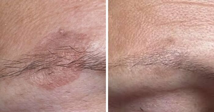 Before and after results of skincare items on Amazon