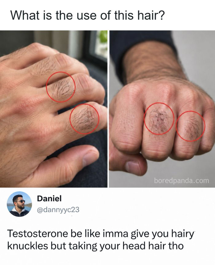 A meme highlighting hairy knuckles and hair loss in entertaining and fun posts.