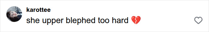 User comment regarding Jennifer Lawrence plastic surgery mentioning she upper blephed too hard.