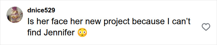 Social media comment about Jennifer Lawrence plastic surgery asking about her face and new project.