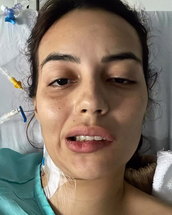 Close-up of a young influencer experiencing facial paralysis while in the hospital Close-up of a young influencer experiencing facial paralysis while in the hospital