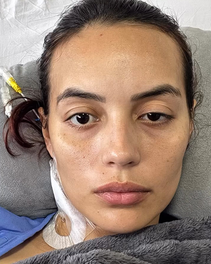Close-up portrait of a young influencer in a hospital bed following facial paralysis treatment. Close-up portrait of a young influencer in a hospital bed following facial paralysis treatment.