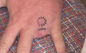 44 Interesting, Cool And A Bit Disturbing Medical Photos And Stories