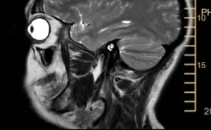 44 Medical Pics That Might Make Even The Most Squeamish Person Curious