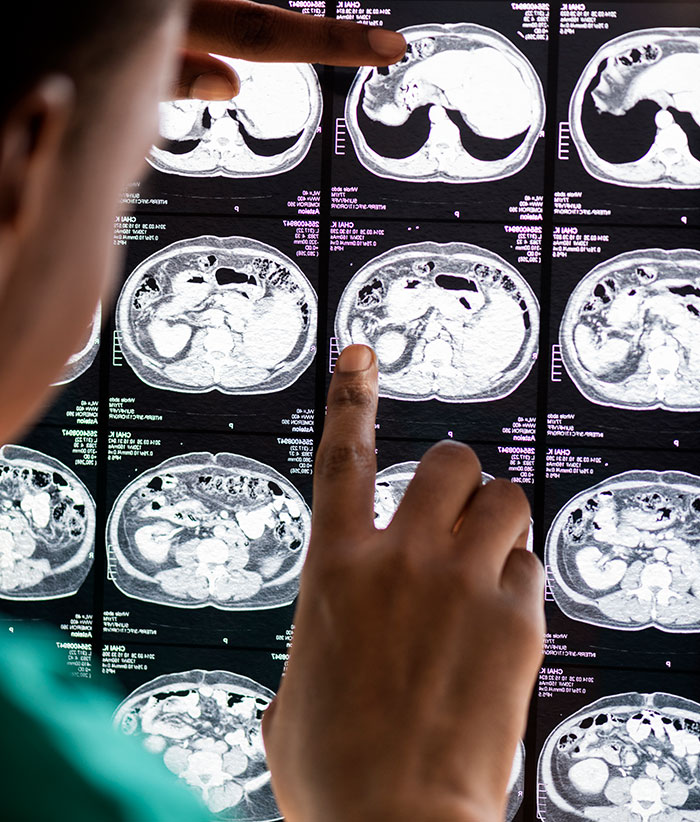 Medical doctor examining a CT scan slice representing worst-case scenarios.