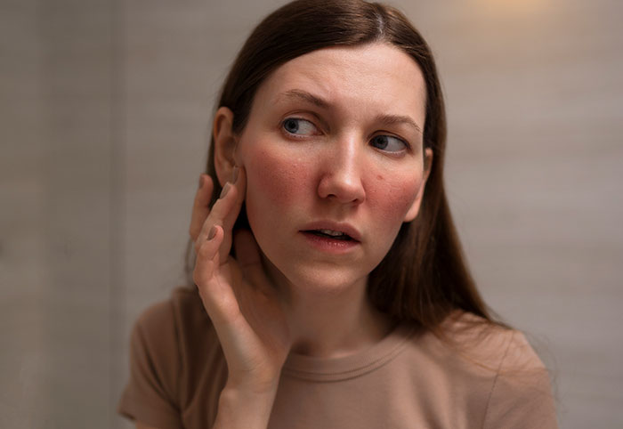 Worried woman touching her face with red skin rash representing worst case scenarios stories.