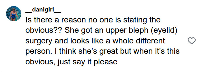 User comment discussing Jennifer Lawrence and plastic surgery procedures.