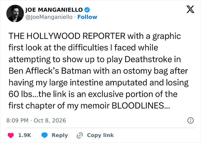 Joe Manganiello tweet detailing his struggles with health issues, an ostomy bag, and a major amputation.