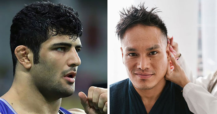Men Are Paying To Get The Ears Of Fighters, Skipping The Fighting And Going Straight To The Surgery