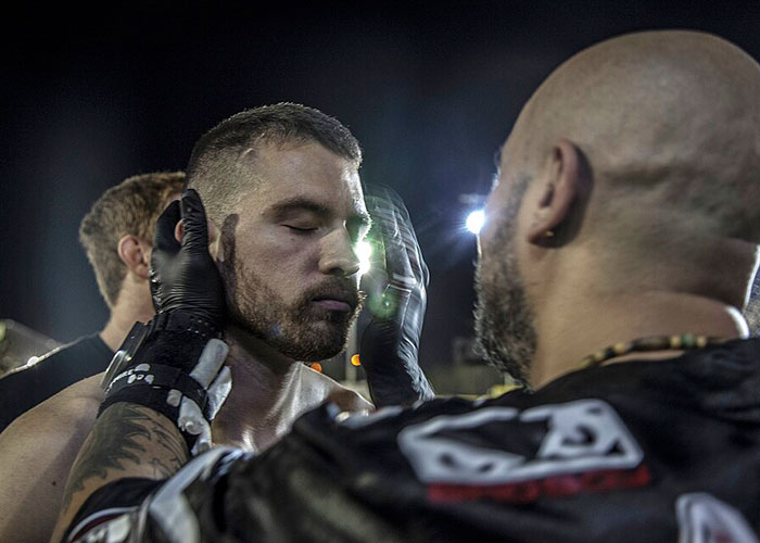 Men Who’ve Never Been In The Ring Are Paying To Get "Cauliflower Ears" And Look Tougher Men Who’ve Never Been In The Ring Are Paying To Get "Cauliflower Ears" And Look Tougher