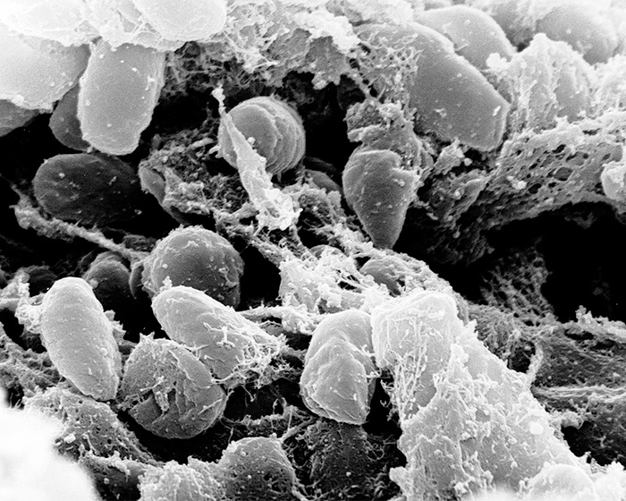 Microscopic view of bacteria, representing the pathogen behind the suspected plague lab leak. Microscopic view of bacteria, representing the pathogen behind the suspected plague lab leak.