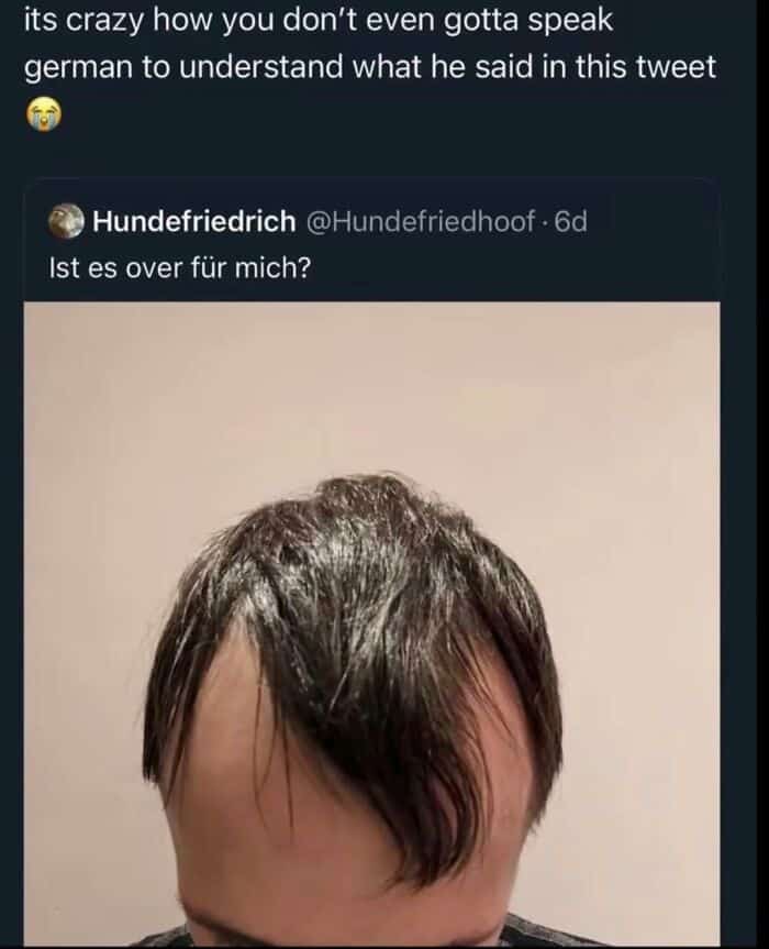 A close-up of a balding man's hair shown as an example of funny insults shared online.