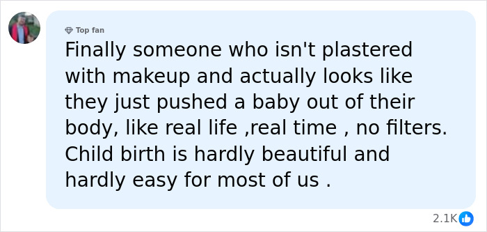 Comment admires Kaley Cuoco's natural look after childbirth without makeup Comment admires Kaley Cuoco's natural look after childbirth without makeup