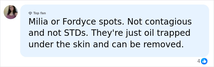 Explanation that milia or Fordyce spots are not contagious white spots on skin