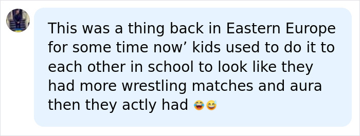 Men Who’ve Never Been In The Ring Are Paying To Get "Cauliflower Ears" And Look Tougher Men Who’ve Never Been In The Ring Are Paying To Get "Cauliflower Ears" And Look Tougher