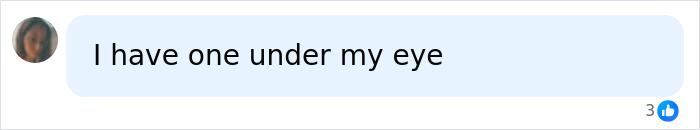 Comment mentioning a white spot under the eye related to skin clusters