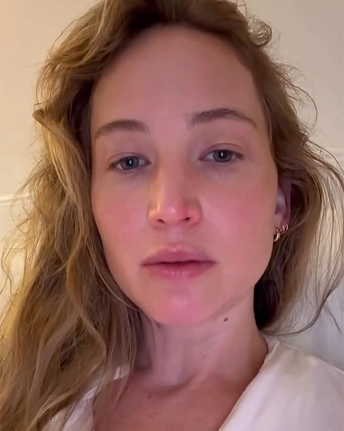 Close-up portrait of Jennifer Lawrence with natural makeup following plastic surgery discussions.