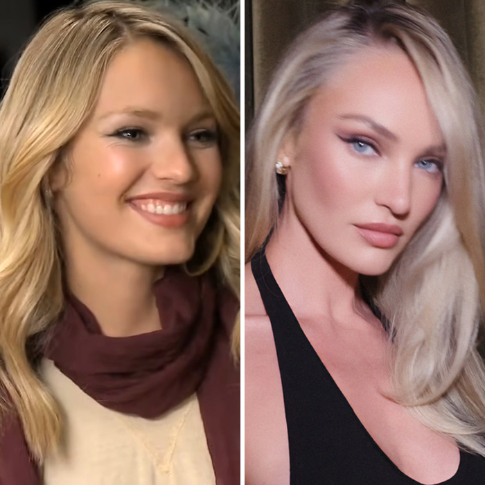 Side-by-side comparison showing Victoria's Secret model Candice Swanepoel before and after plastic surgery. Side-by-side comparison showing Victoria's Secret model Candice Swanepoel before and after plastic surgery.