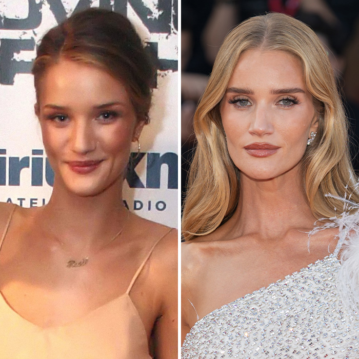 Before and after plastic surgery photos of Victoria's Secret model Rosie Huntington-Whiteley. Before and after plastic surgery photos of Victoria's Secret model Rosie Huntington-Whiteley.