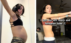 Woman Tried Diet And Exercise For Years To Fix Belly, Shows Off Transformation After Finally Figuring Out The Problem