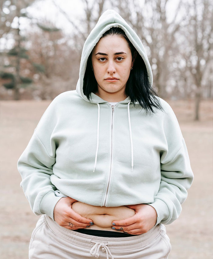 Woman Thought Getting Thin Would Change Her Whole Life, Learns The Hard Way That It Didn&rsquo;t