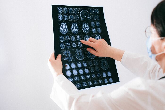 Doctor looking at brain scans, highlighting human body facts about the nervous system.