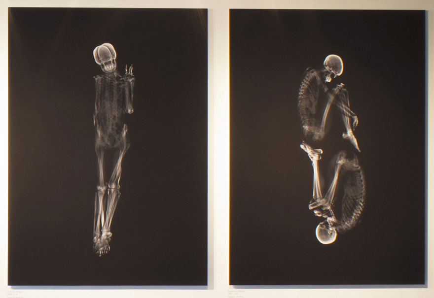 Intimate X-Ray Portraits of Couples by Ayako Kanda and Mayuka Hayashi